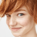 How To Get Rid Of Freckles