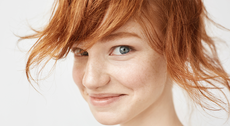 How To Get Rid Of Freckles