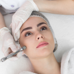 Myths About Microdermabrasion