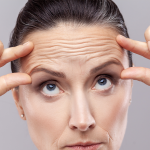 Get rid of wrinkles naturally