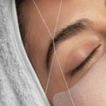 can threading cause acne