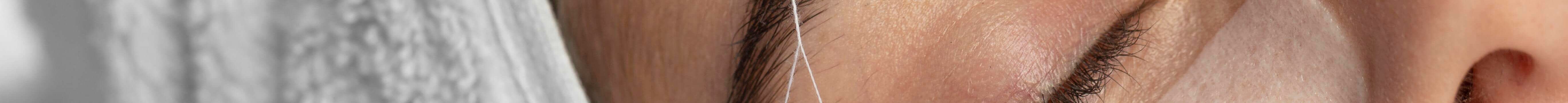 can threading cause acne