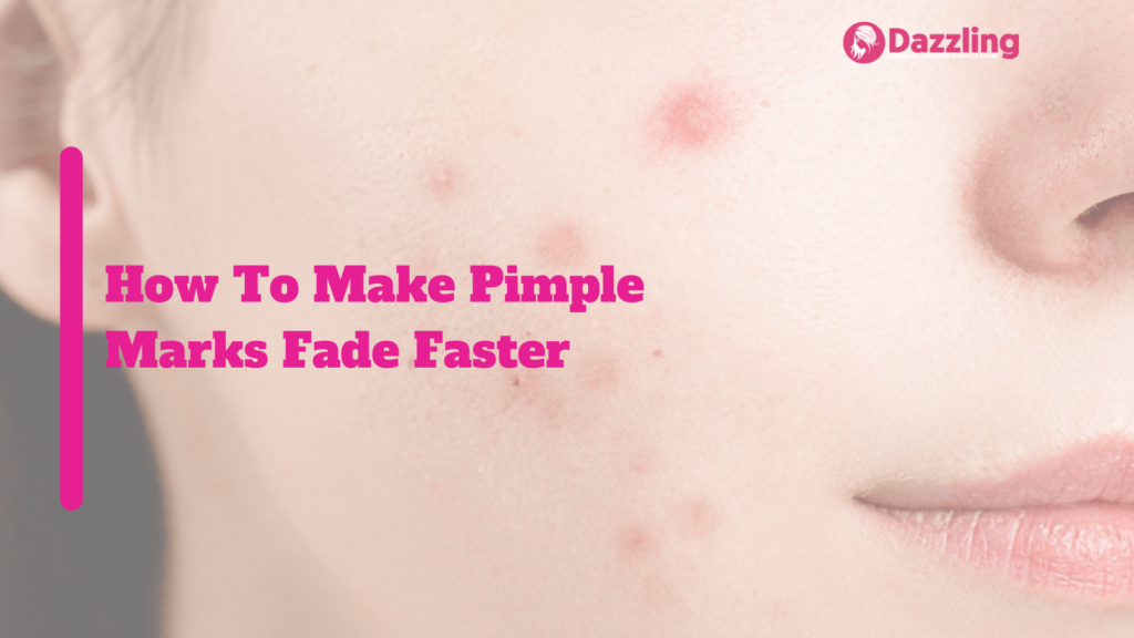 How To Make Pimple Marks Fade Faster