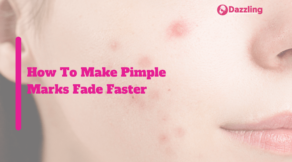 How To Make Pimple Marks Fade Faster