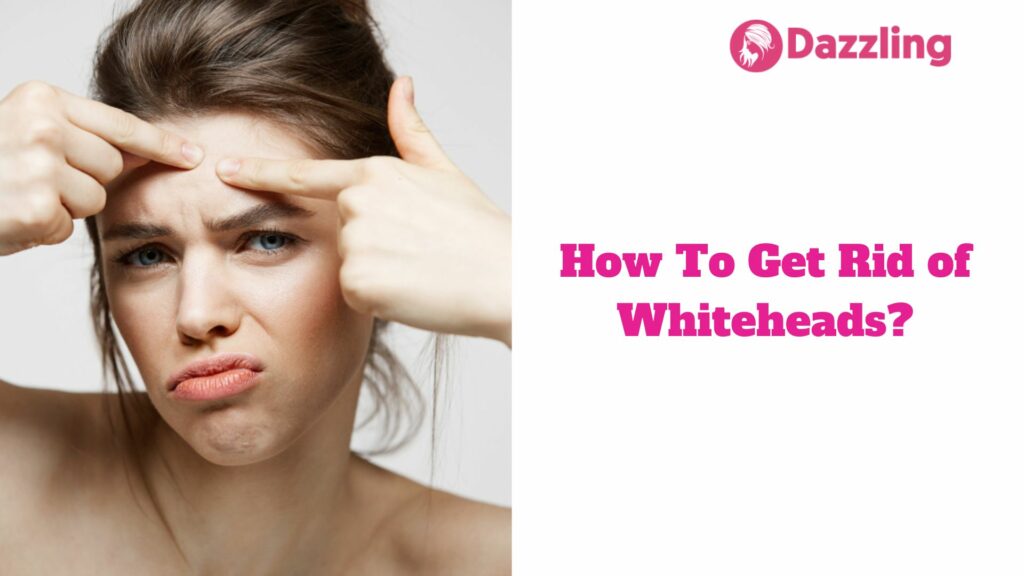 How To Get Rid of Whiteheads?
