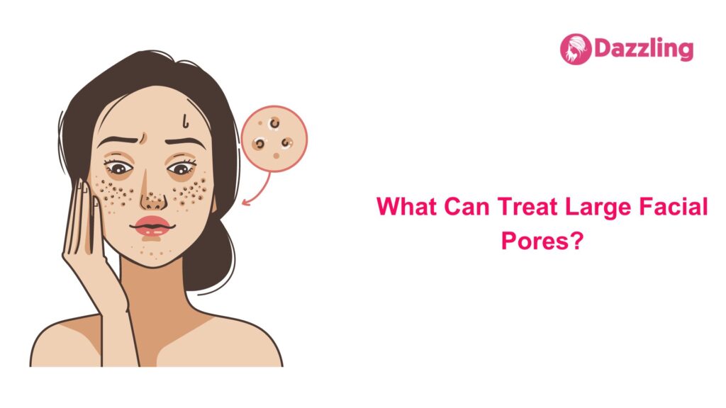 What Can Treat Large Facial Pores?