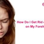How Do I Get Rid of a Pimple on My Forehead?