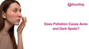 Does Pollution Cause Acne and Dark Spots?