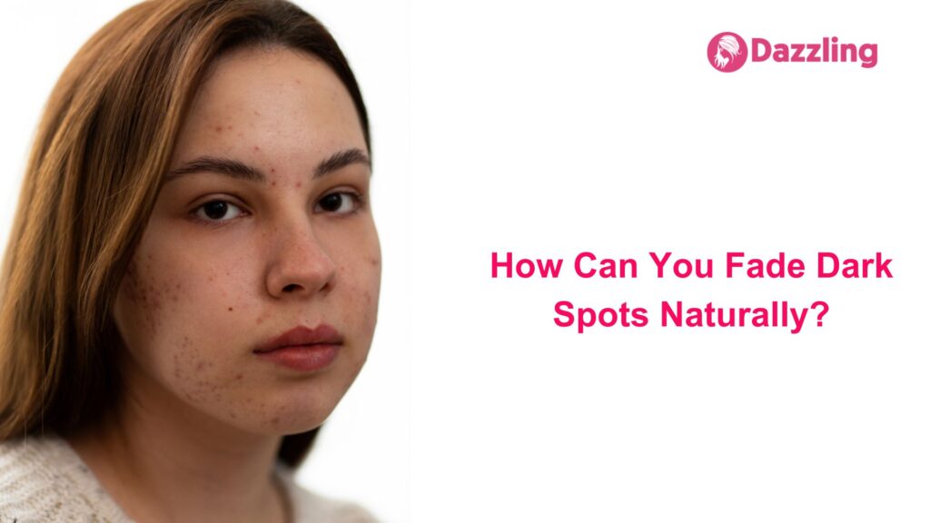 How Can You Fade Dark Spots Naturally?