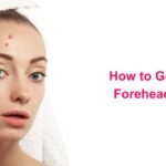 How to Get Rid Of Forehead Acne?